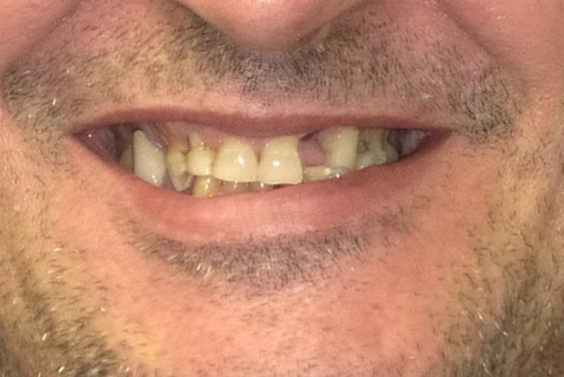 Dr. Fetsch Before and after case