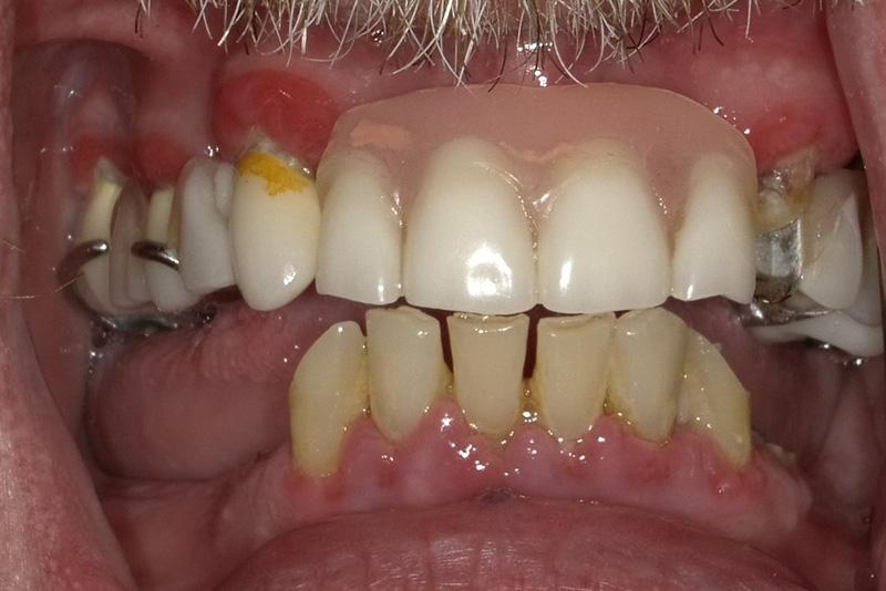Dr. Fetsch Before and after case