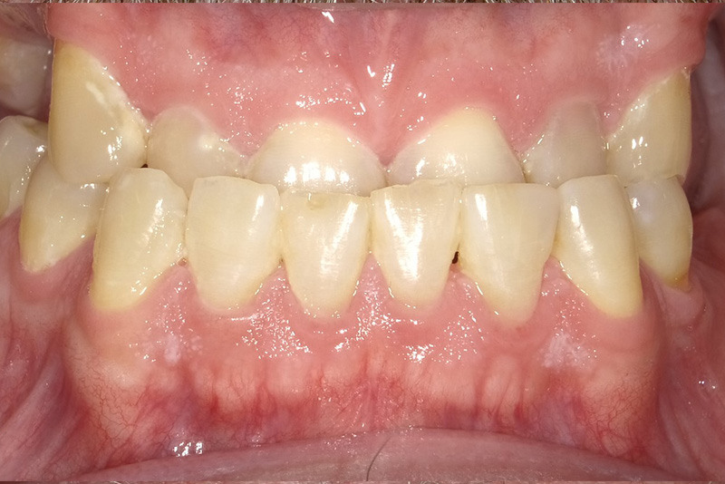 Dr. Fetsch Before and after case