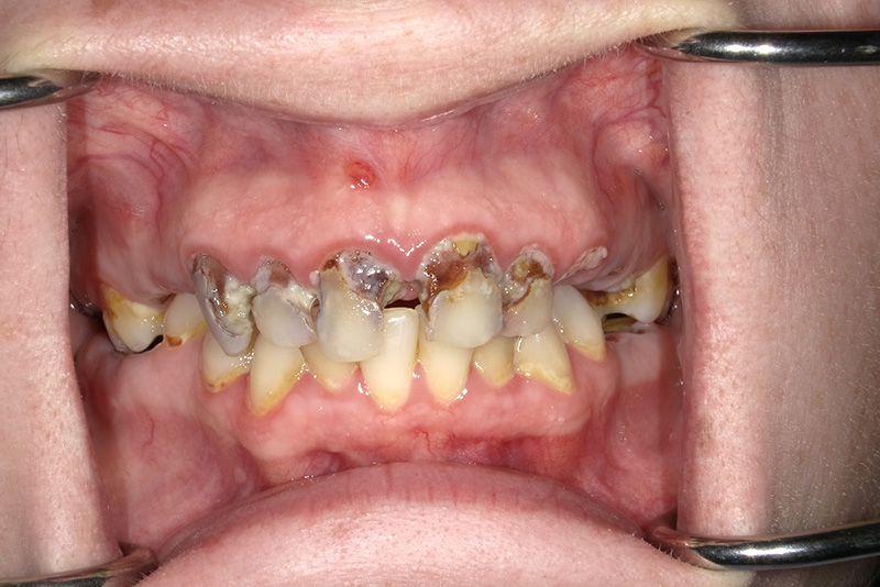 Dr. Fetsch Before and after case