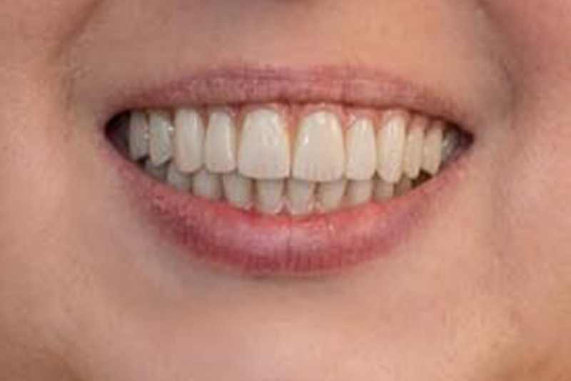 Dr. Fetsch Before and after case