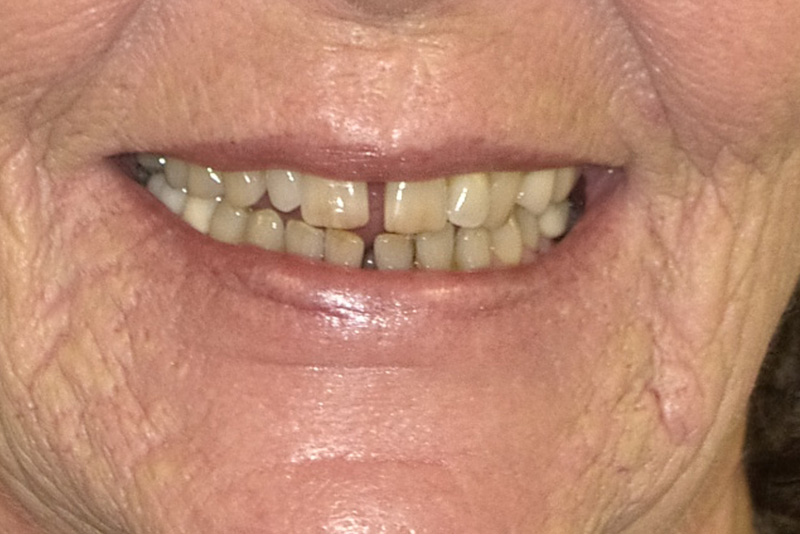 Dr. Fetsch Before and after case