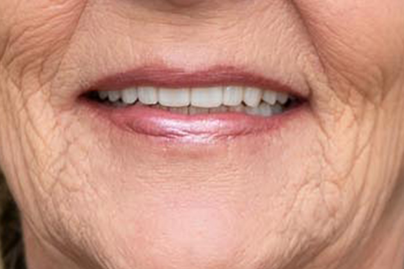 Dr. Fetsch Before and after case