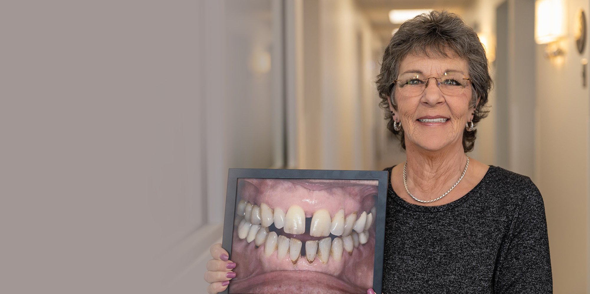 Dr. Fetsch Before and after picture