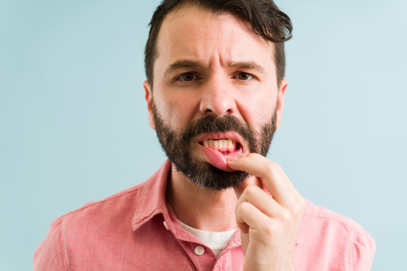 a guy with gum disease holding his lip down to see the inflammation
