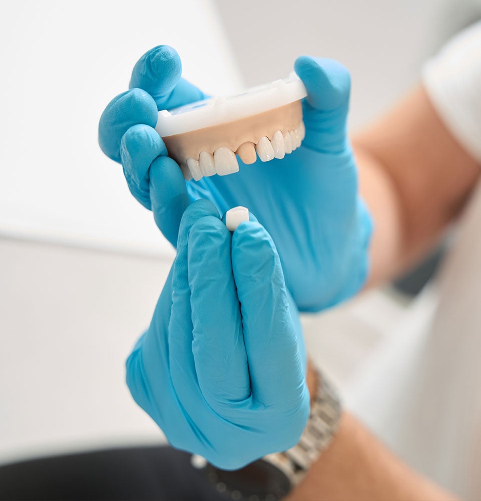 close up of dental crown