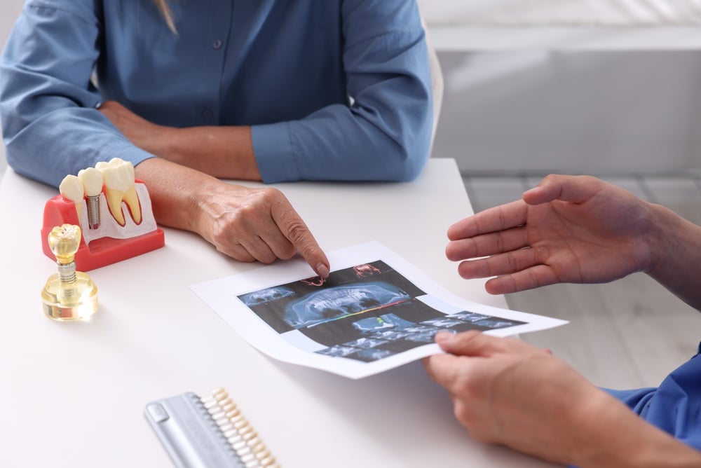 How Much is a Dental Implant? Breaking Down the Costs