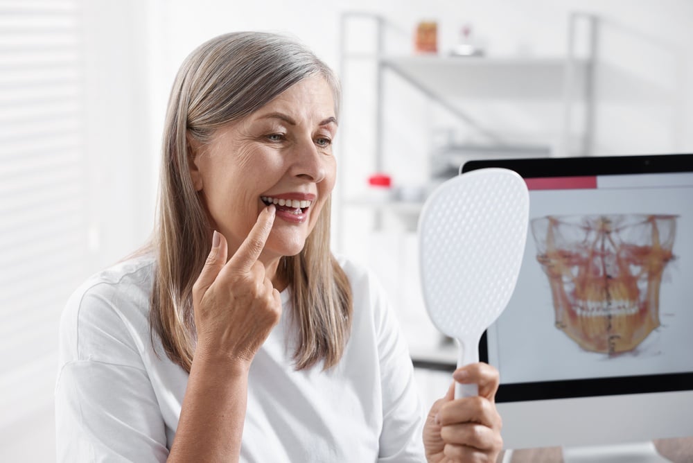 How to Care for Your Dental Implants After Surgery for Long-Lasting Results